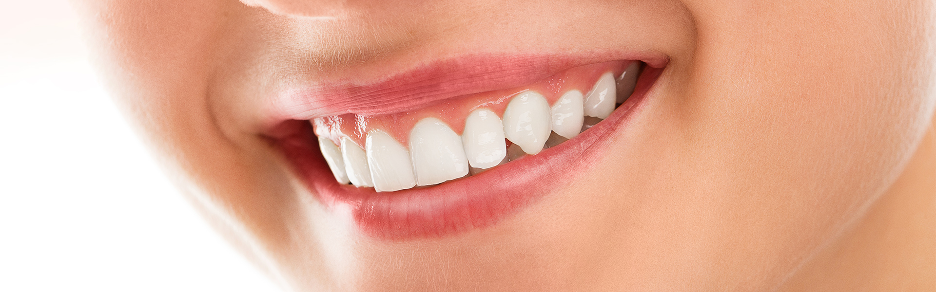 Teeth Contouring and Reshaping: A Gentle Solution for a Perfect Smile